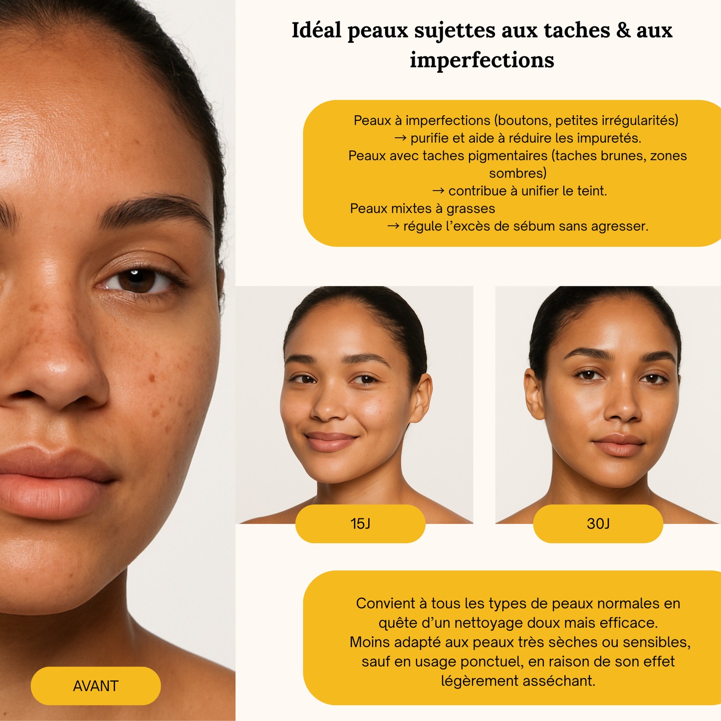 Savon Curcuma - Visage & Corps - Peaux à Imperfections