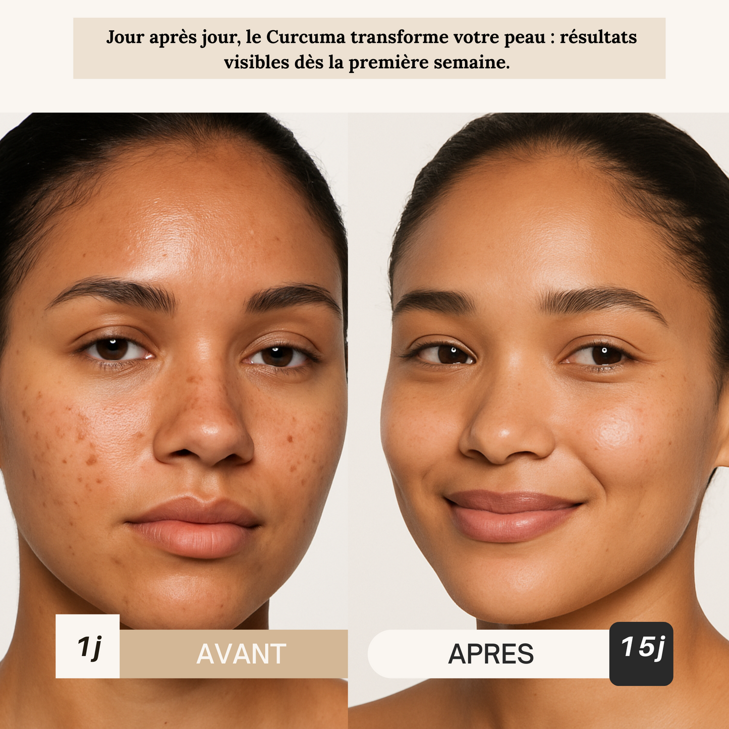 Routine Curcuma Anti-Taches & Acné Visage