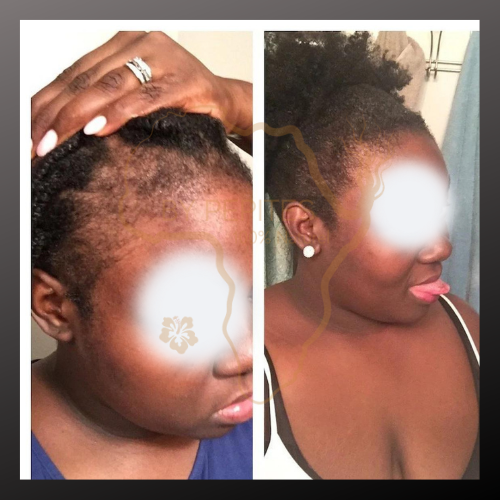 Crème Spéciale Pousse Baby Hair, Barbe, Cils & Sourcils