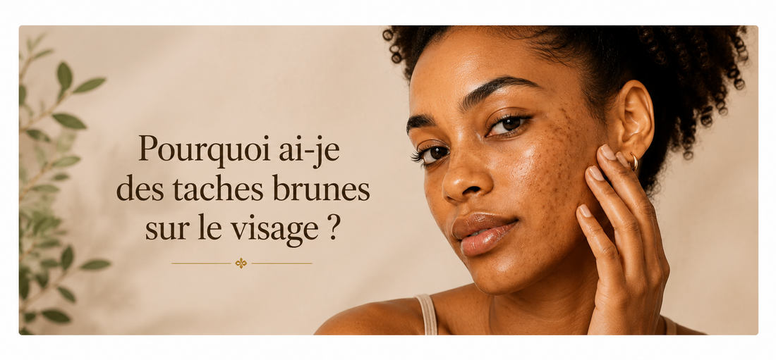 Comment prévenir les taches brunes naturellement