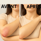 Huile de Carapa Procera – Touloucouna 100 % pure