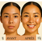 Élixir Précieux – Visage - Peaux à Imperfections