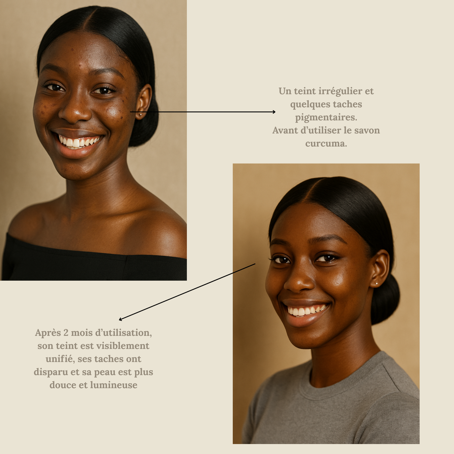 Savon Nila – Éclat & Correction des Taches Pigmentaires