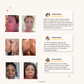 Routine Curcuma Anti-Taches & Acné Visage