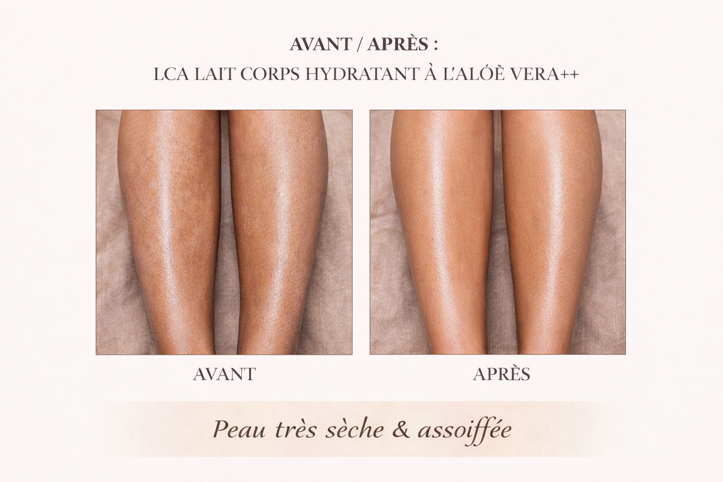 Lait Corps Hydratant à l’Aloé Vera – LCA