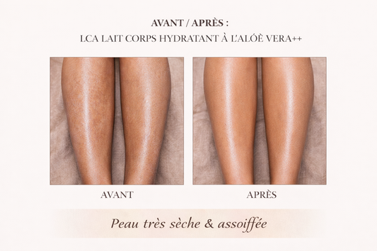 Lait Corps Hydratant à l’Aloé Vera – LCA