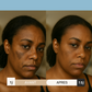 Routine Nila zones sombres - Solutions hyperpigmentation - Visage