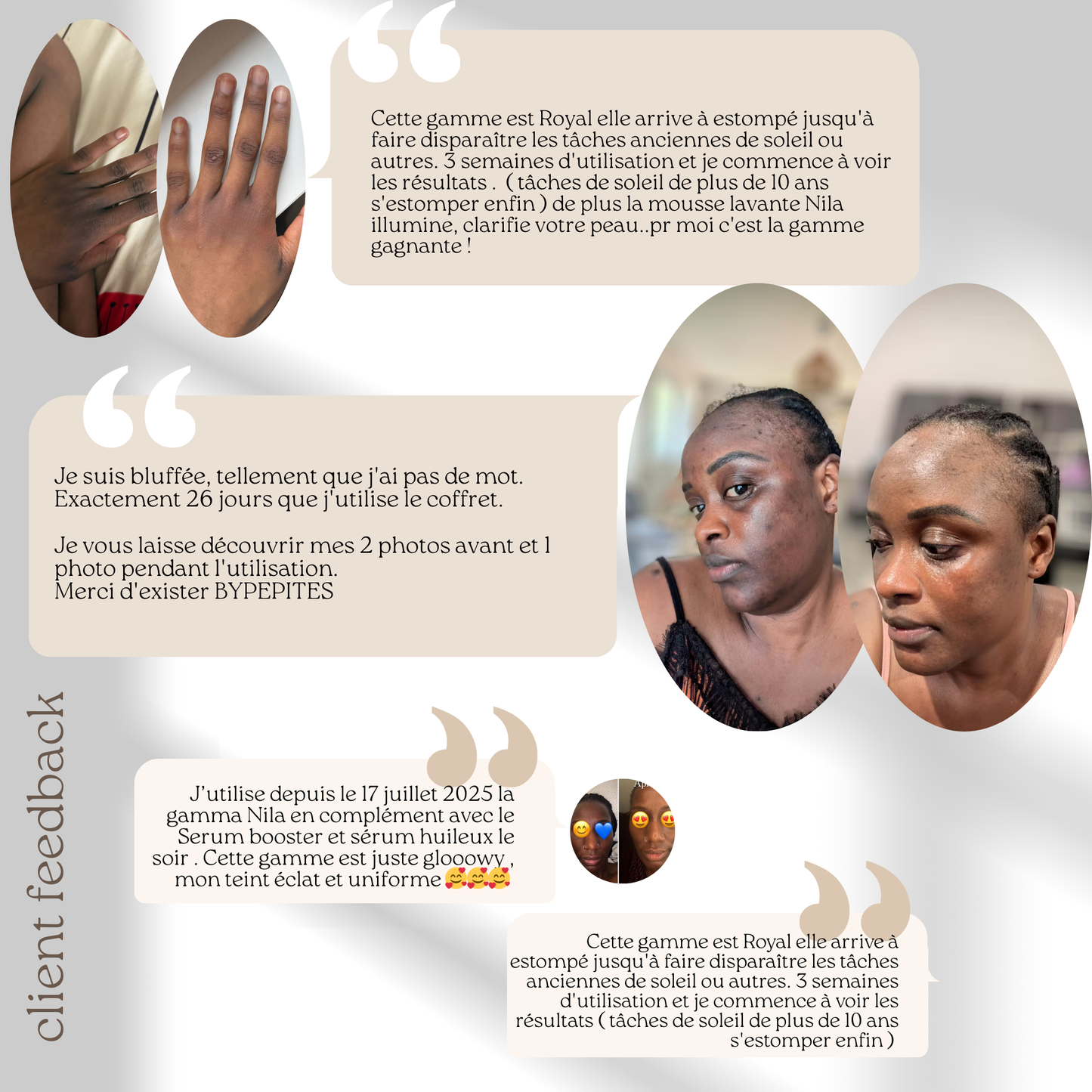 Routine Nila zones sombres - Solutions hyperpigmentation - Visage